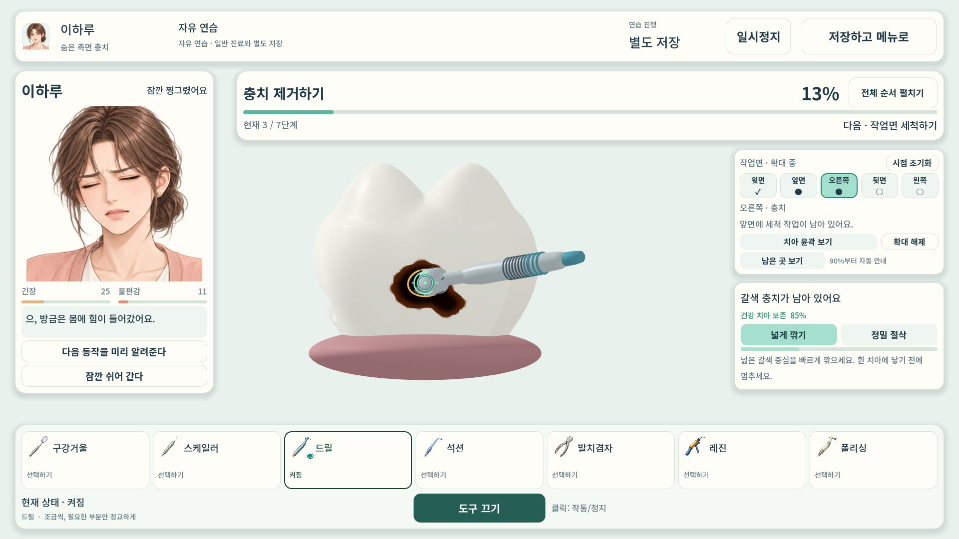 환자 표정과 치료 진행률을 보며 3D 치아 옆면의 충치를 드릴로 제거하는 화면